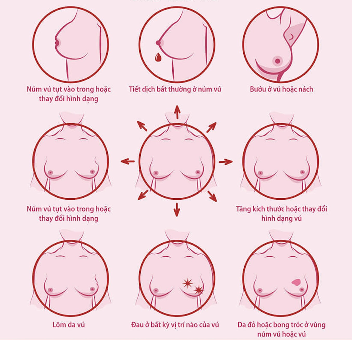 Cách nhận biết ung thư vú: Dấu hiệu và phương pháp phát hiện sớm bạn cần biết